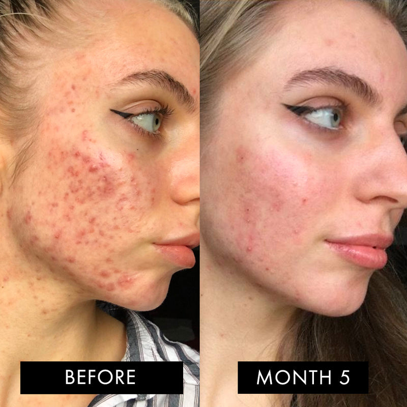 The Skin Elixir
