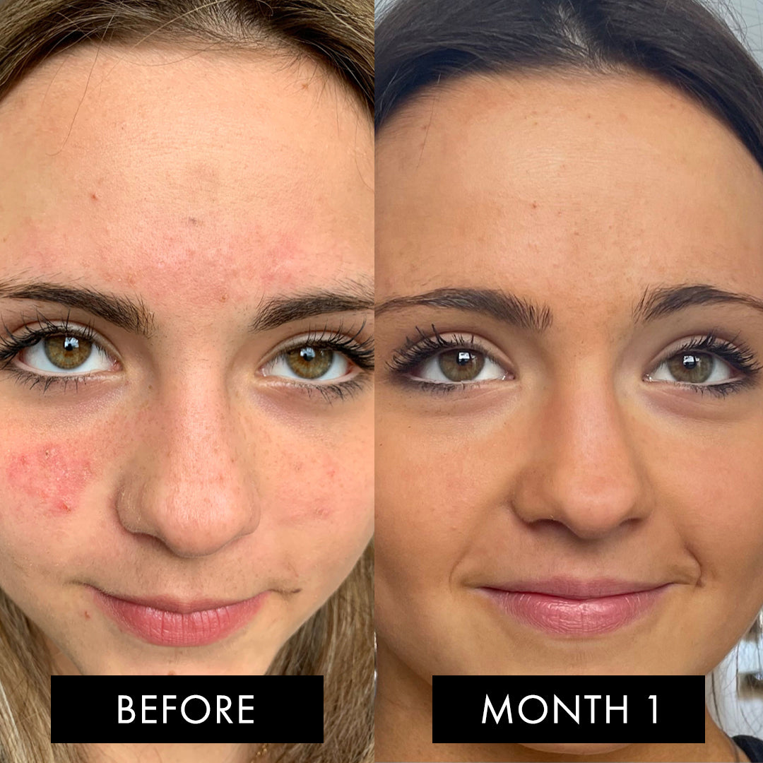 The Skin Elixir Three Month Pack